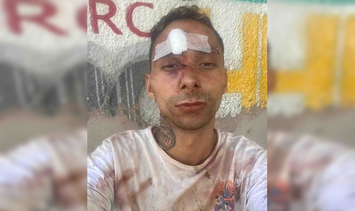 Casal gay é agredido em bar