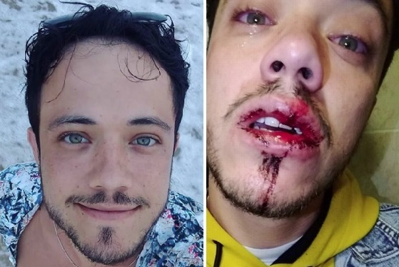 https://www.guiagaysalvador.com.br/public/uploads/imagens/originais/danilo_matta_brasileiro_gay_atacado_agredido_homofobia_irlanda_dublin.jpg