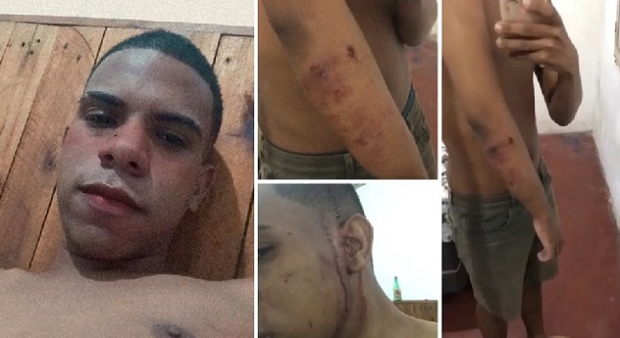 DJ Herbert Almeida, da boate gay Tropical Club de Salvador, é atacado por homofobia
