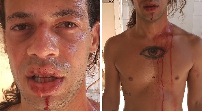 Guiaz, irmão gay do repórter André Azevedo, é atacado por 7 homens
