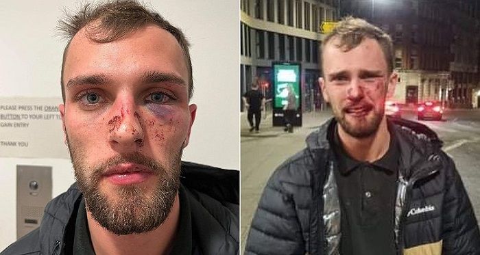 Homem gay é atacado por seguranças de boate gay em Manchester, na Inglaterra