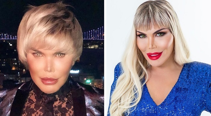 Ken Humano, Rodrigo Alves agora é Roddy e transexual