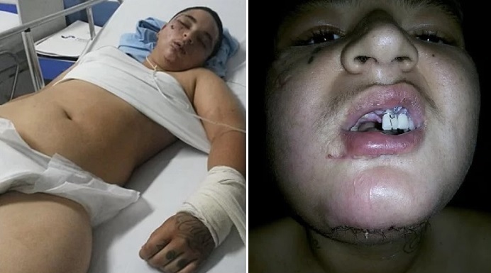 Thaylanne Costa: lésbica de 17 anos é espancada em Goiás