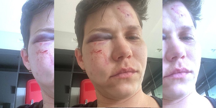 Polícia: bolsonarista Karol Eller mentiu e não houve homofobia
